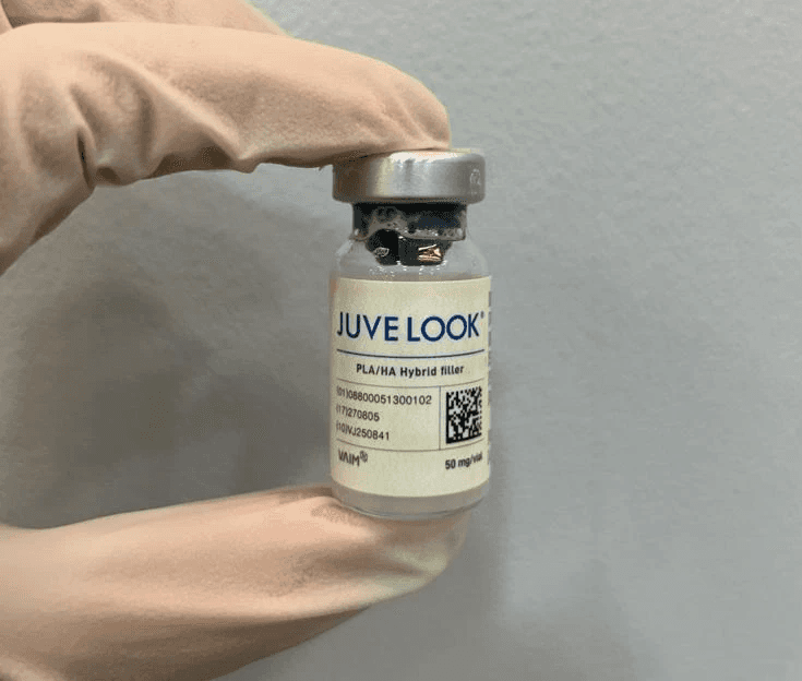 Who Benefits Most from Sofwave? Sofwave with No Worry About Cheek Volume Loss