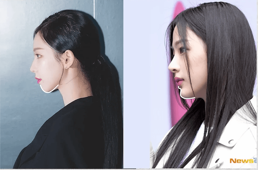 วิธีเพิ่มประสิทธิภาพการรักษาสิวด้วยการฉีดยา