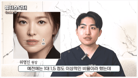 입술필러 1cc, 인중 길이 짧아보이는 이유