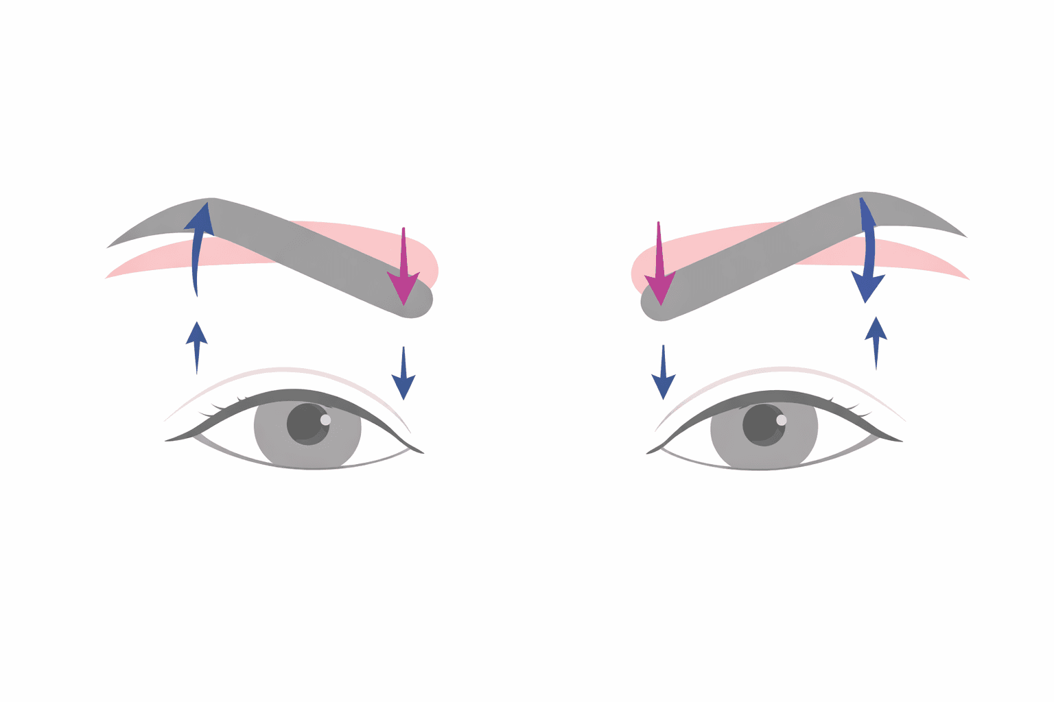 미간이마보톡스부작용 걱정된다면 꼭 읽어보세요