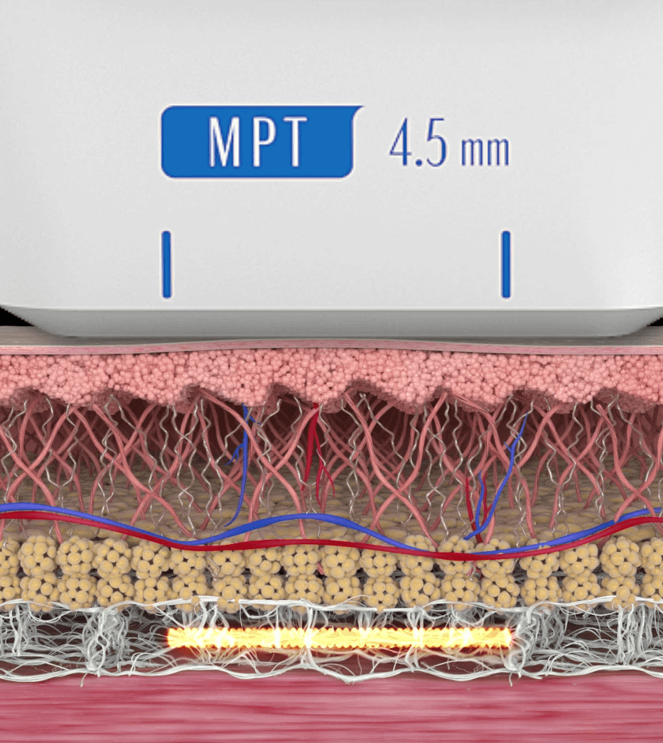 올리지오 vs 슈링크 비교