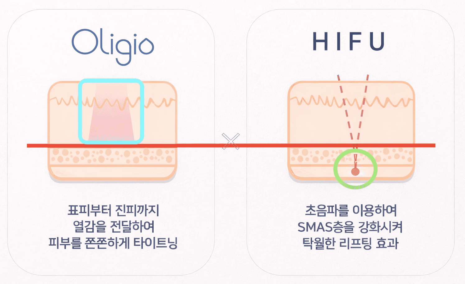 올리지오 vs 슈링크 비교
