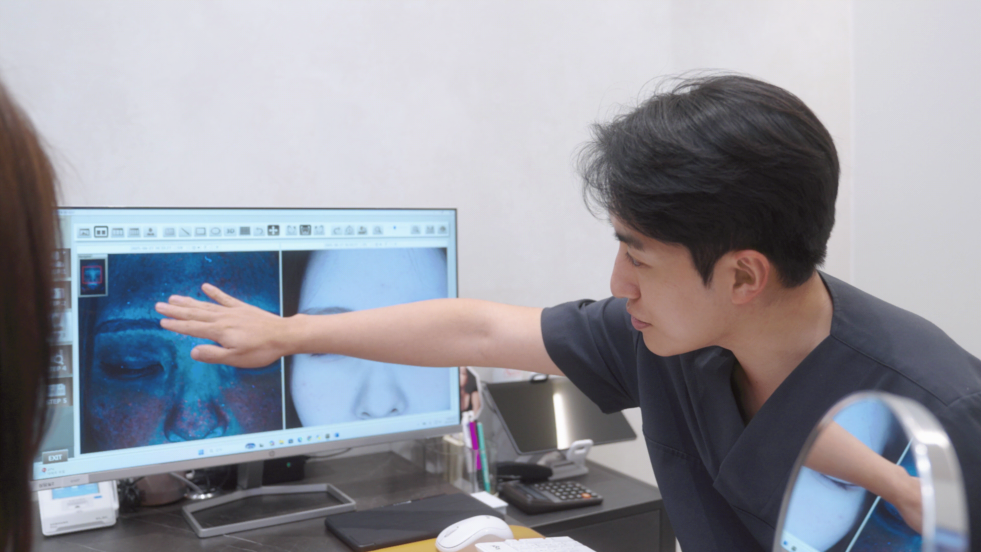 피코레이저로 잡티기미주근깨 없애기