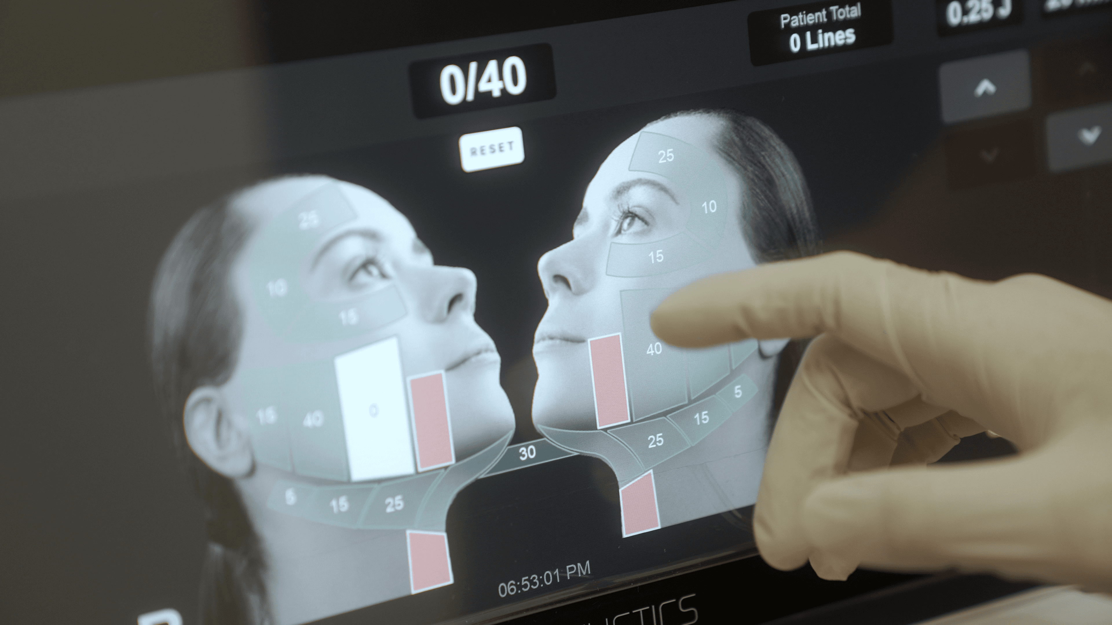 ウルセラピプライムを受けて後悔する理由、男性と女性の違い