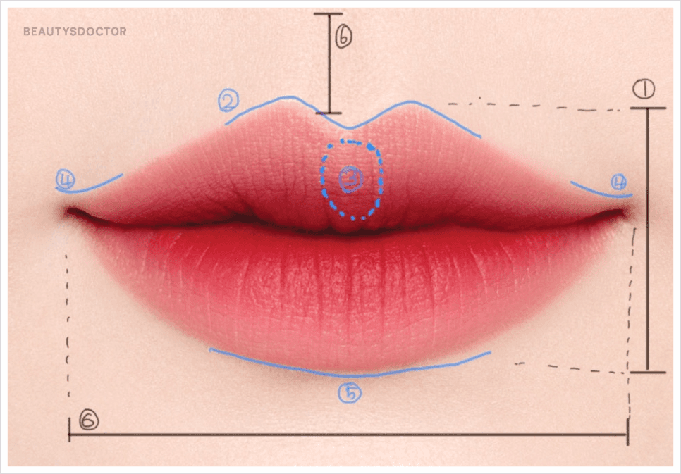 唇フィラー 1cc、口唇の長さが短く見える理由