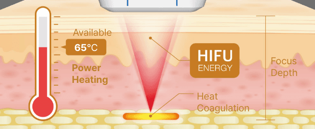 Shrink Universe 300發效果夠嗎？
