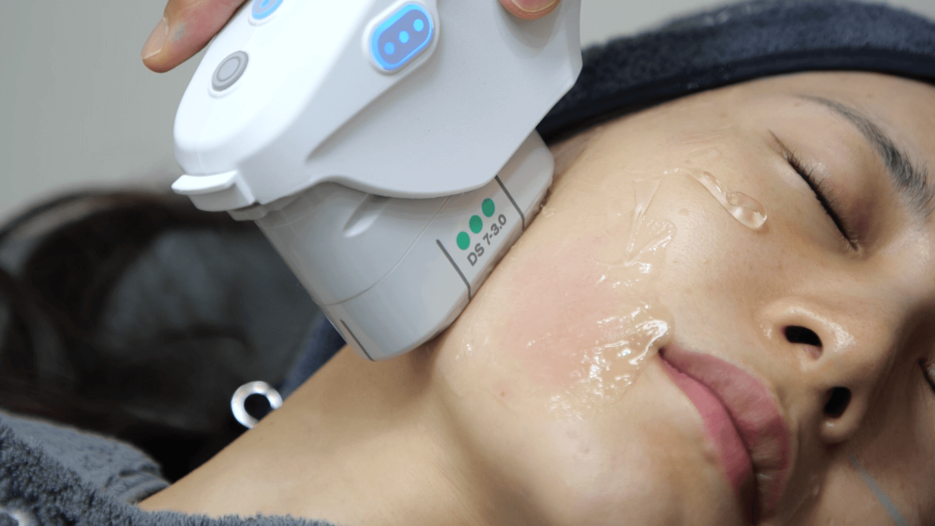 ウルセラ vs サーマジの違い比較