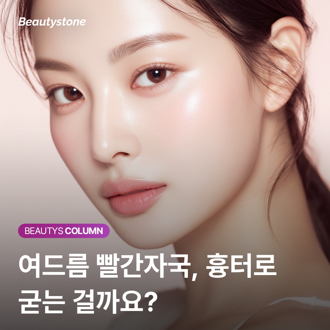 여드름 회복 과정 단계별 피부 변화