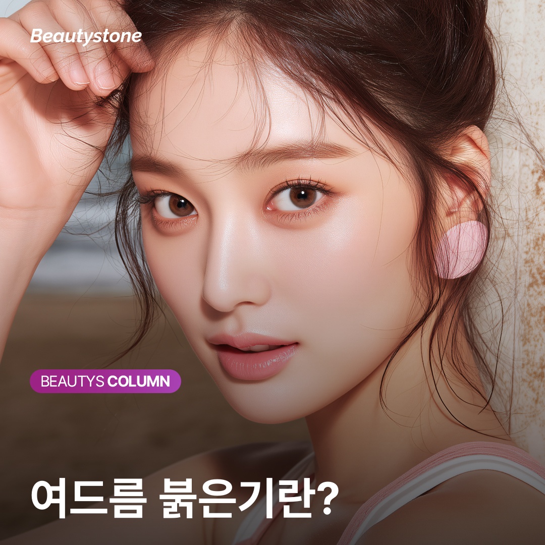 여드름 붉은기 PIE 혈관 확장 원리 설명