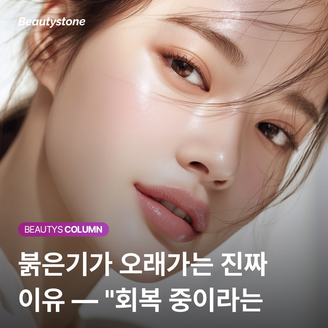 여드름 붉은기 재생연고 사용 가이드