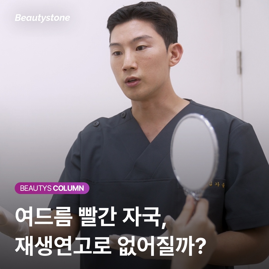 여드름 자국 재생연고 추천 피부과 설명