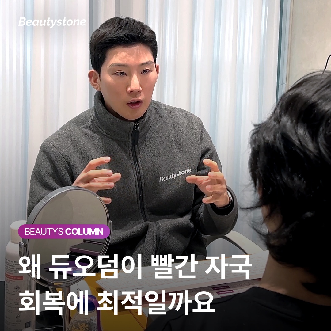 ニキビを潰した後のデュオデルム貼付前後の比較