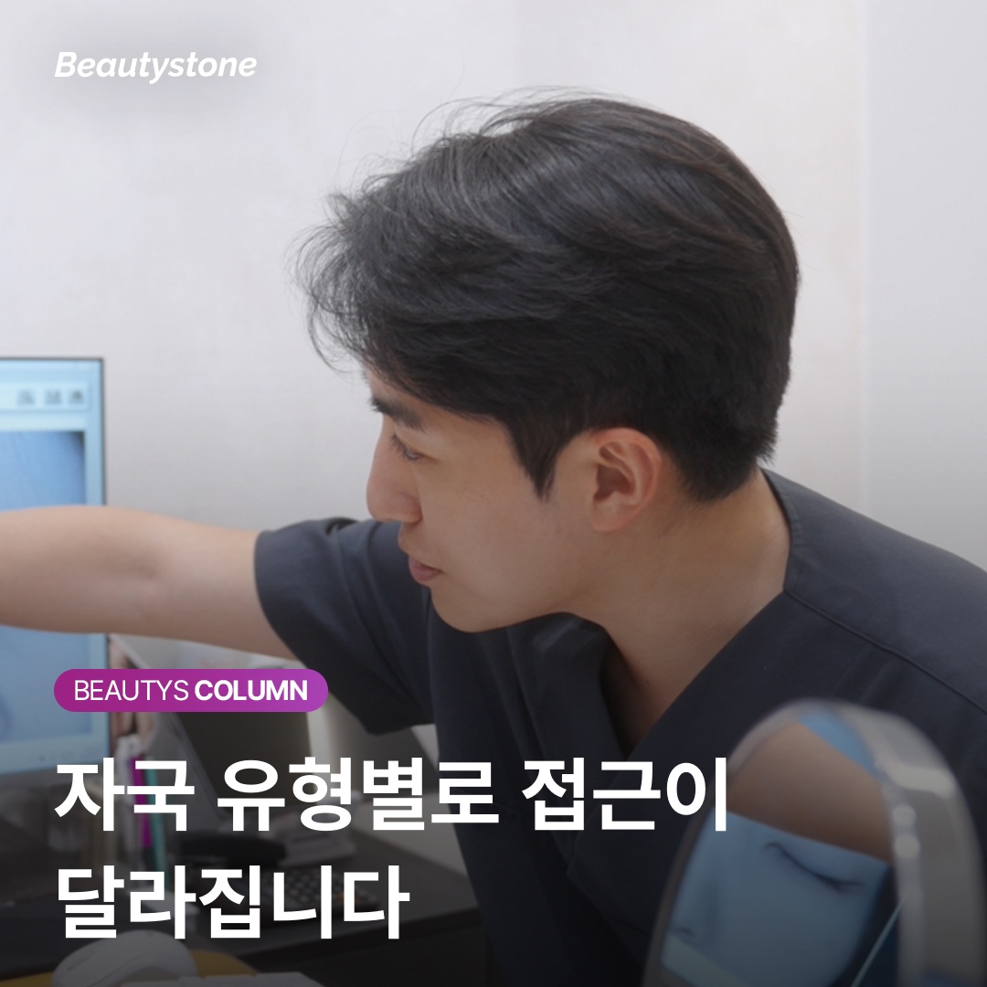 วิธีรักษารอยสิวแต่ละประเภทที่คลินิกผิวหนัง