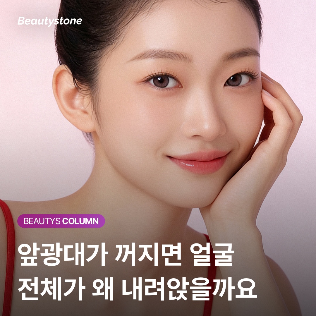 쥬비덤 볼루마 광대 주입 층위별 리프팅 벡터 차이