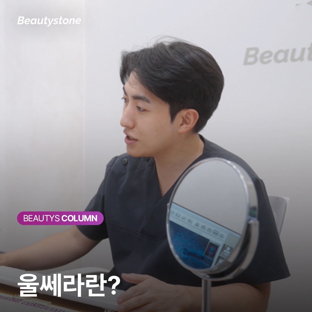 ウルセラの超音波エネルギーが皮膚層に作用する仕組み