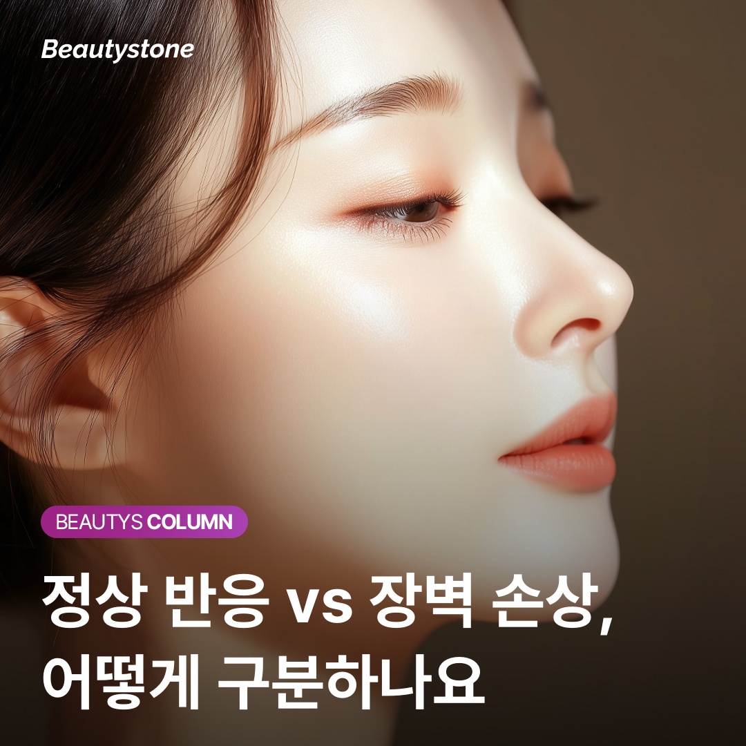 Skin barrier recovery stages after retinol discontinuation