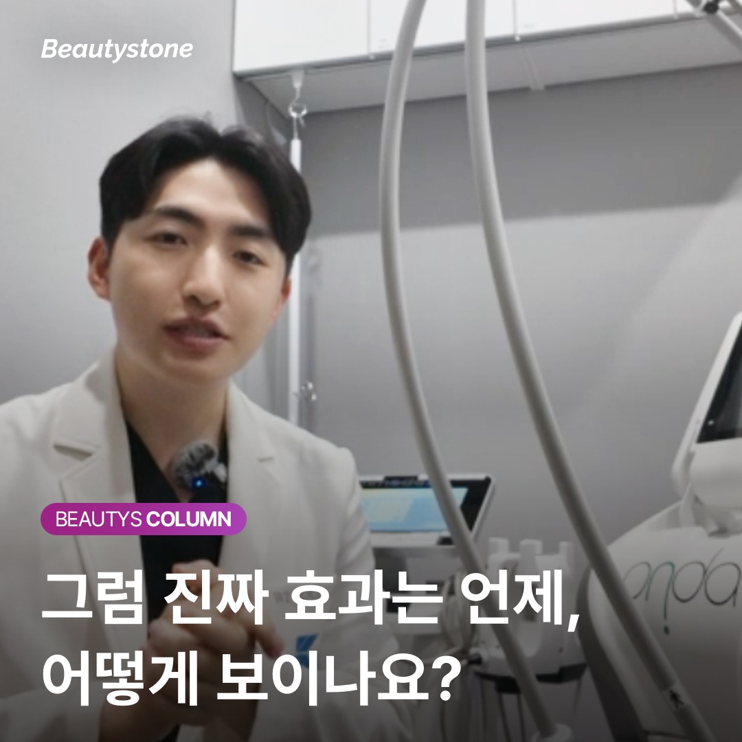 Sculptra procedure suitable candidate type comparison