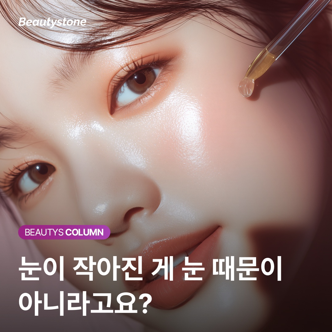 太陽穴凹陷體積恢復