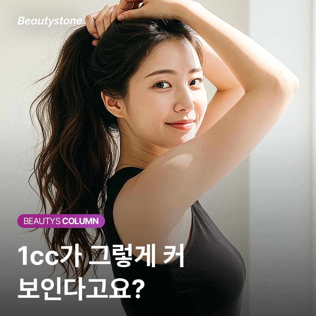 骨盤フィラーのビフォーアフター比較写真 ボリューム変化