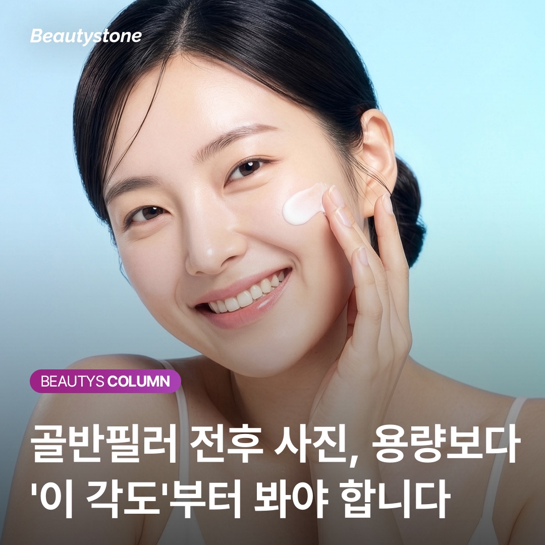 骨盤フィラー注入ポイント解剖学的位置