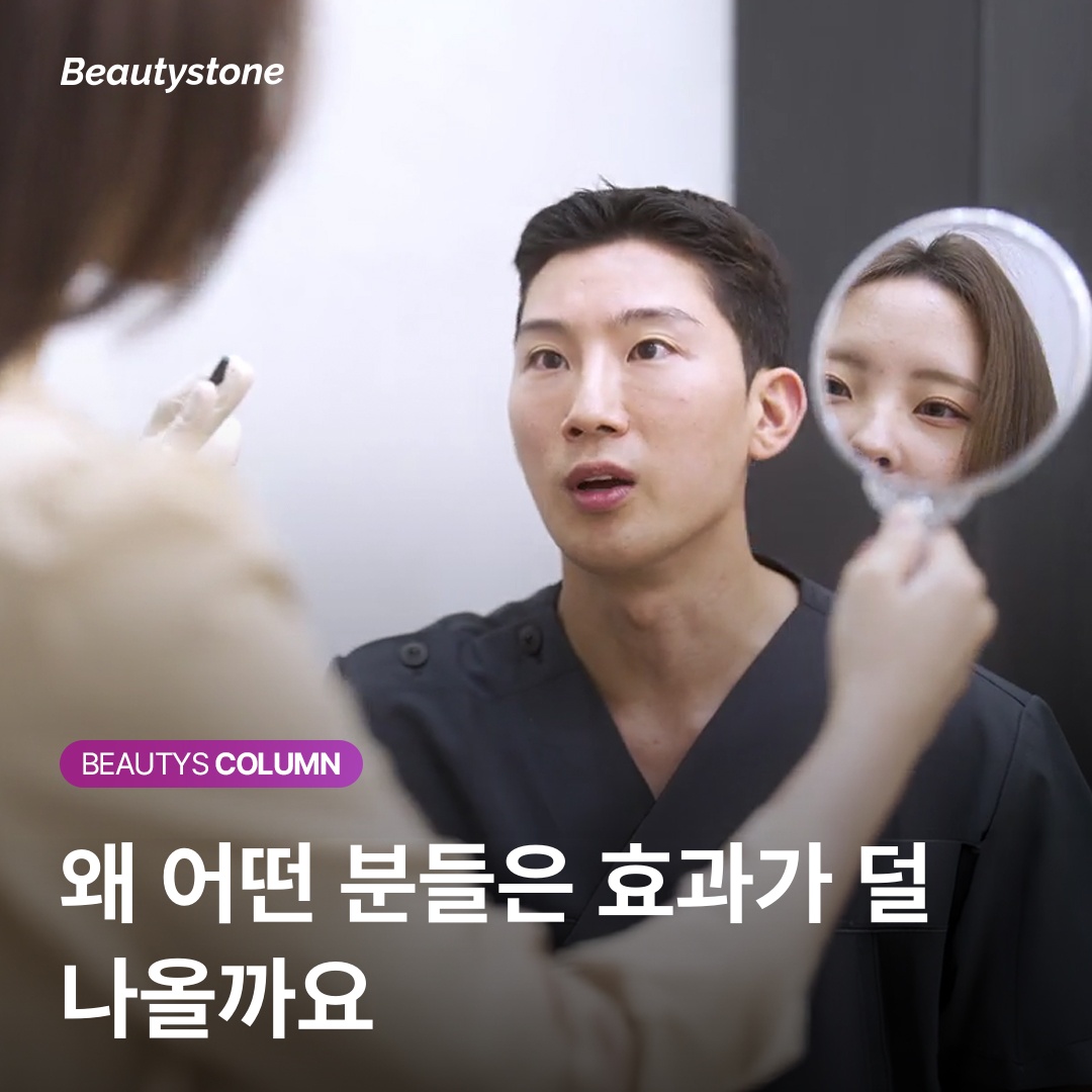 シークレットRF タイプ別 適応症 ガイド