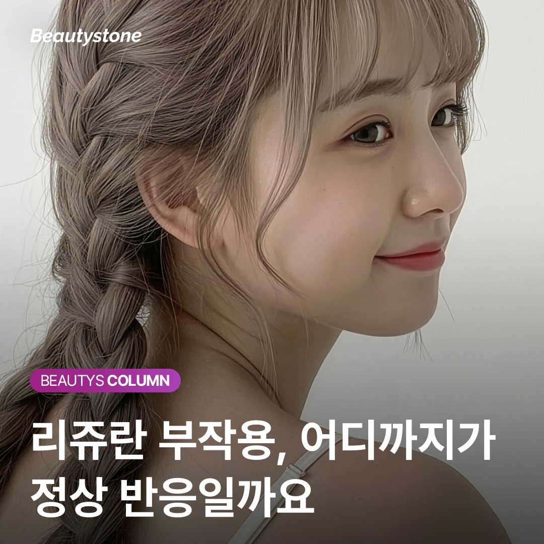 丽珠兰結節形成機制注射深度