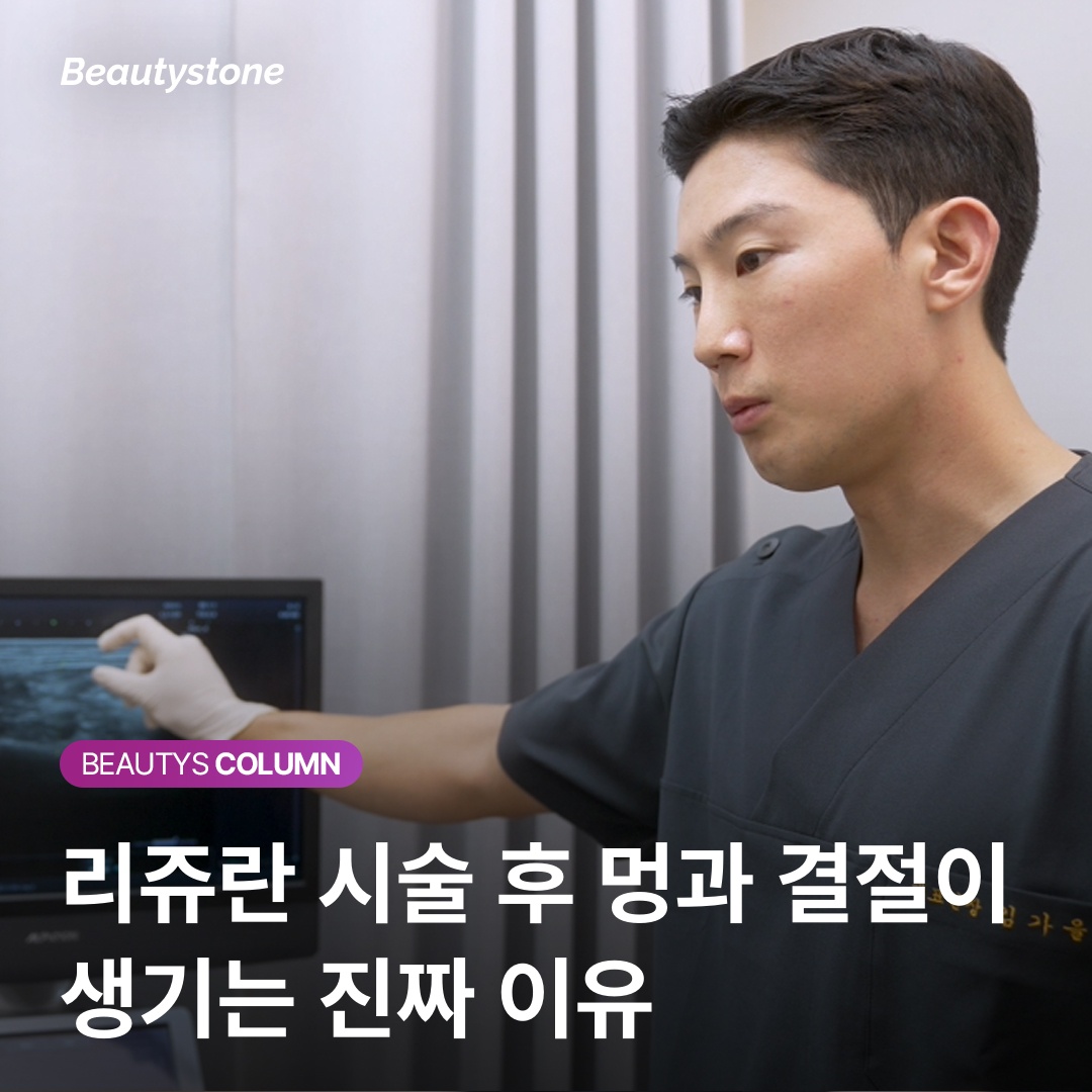 丽珠兰副作用各類型注意事項