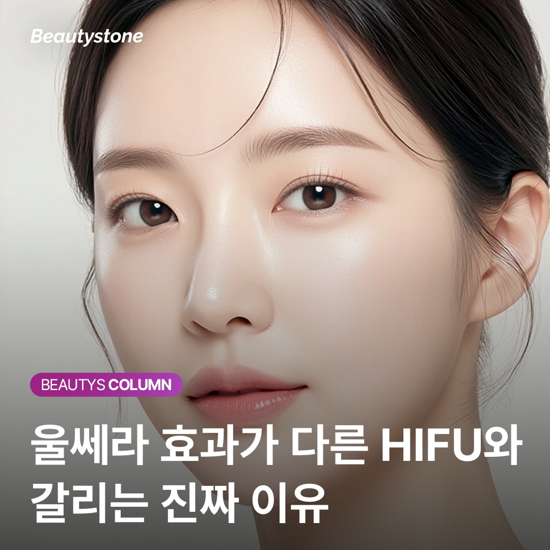 คู่มือข้อบ่งชี้ของอัลเทอร่าแยกตามประเภท