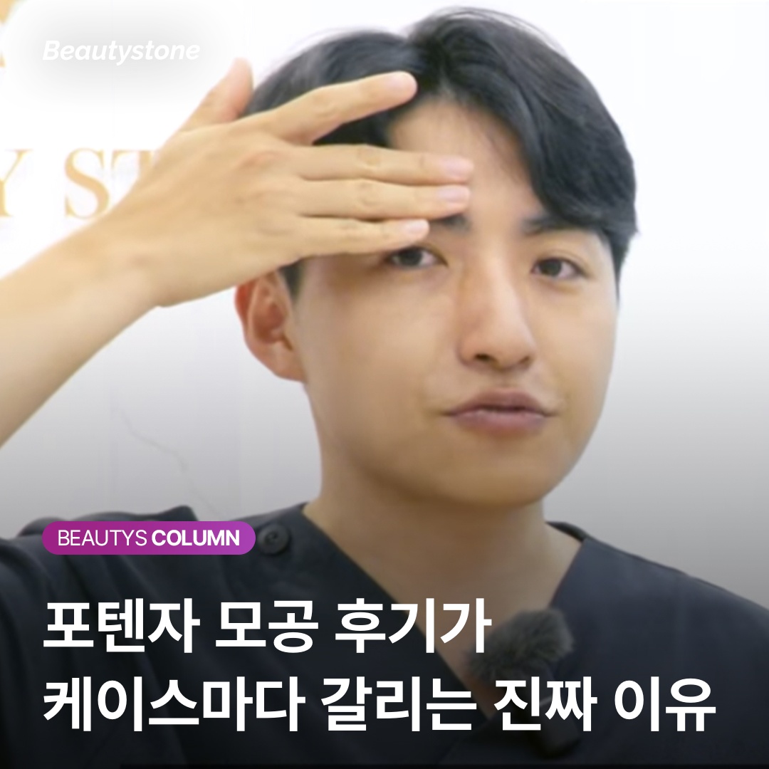 แนวทางการรักษาพอเทนซ่าตามประเภทผิว