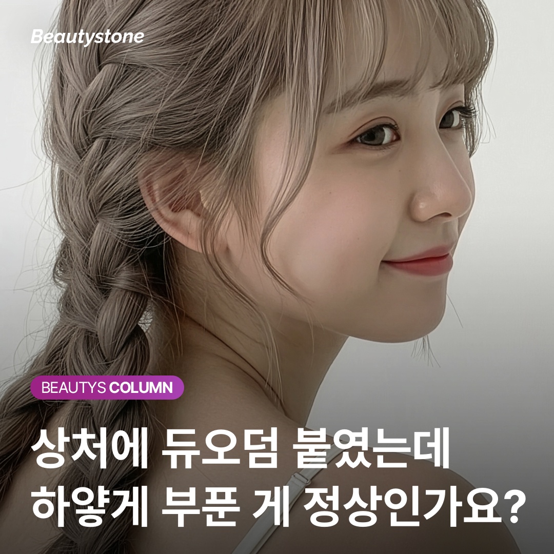 듀오덤 하이드로콜로이드 젤화 원리