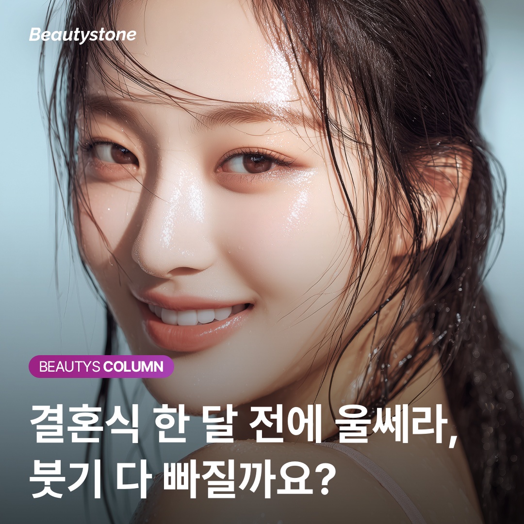 울쎄라 SMAS층 열응고점 형성