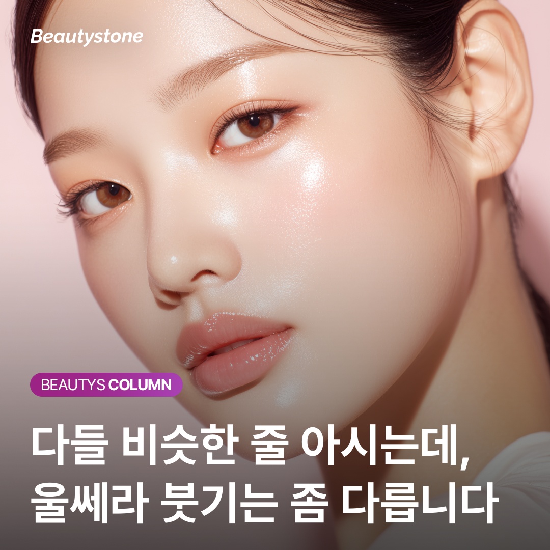 울쎄라 시술 후 붓기 경과 타임라인