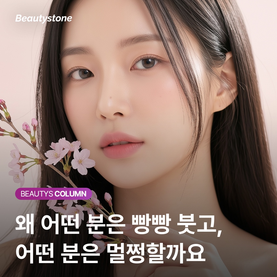 울쎄라 시술 시점 권장 가이드