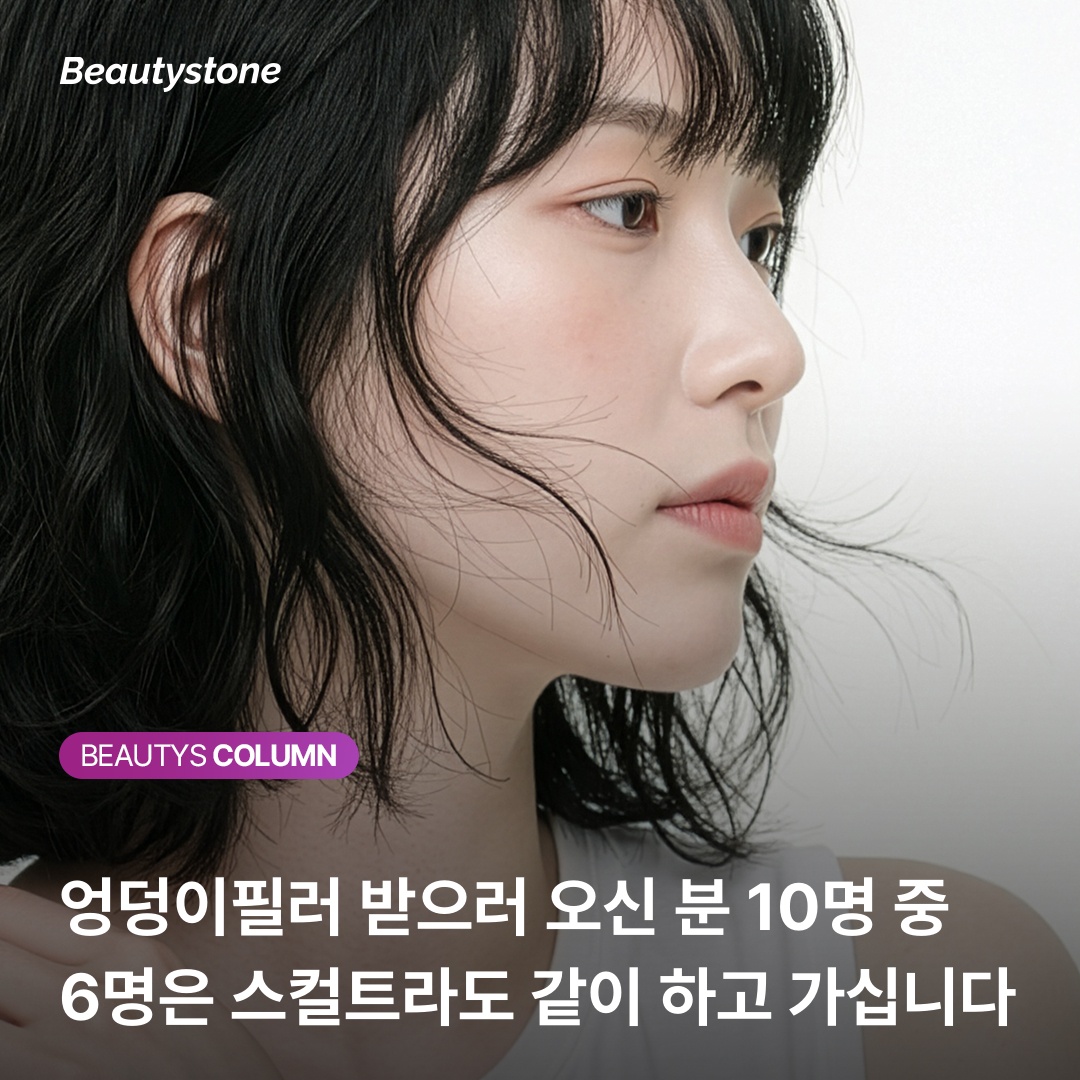 Diagram explaining the upper gluteal region and hip dip area