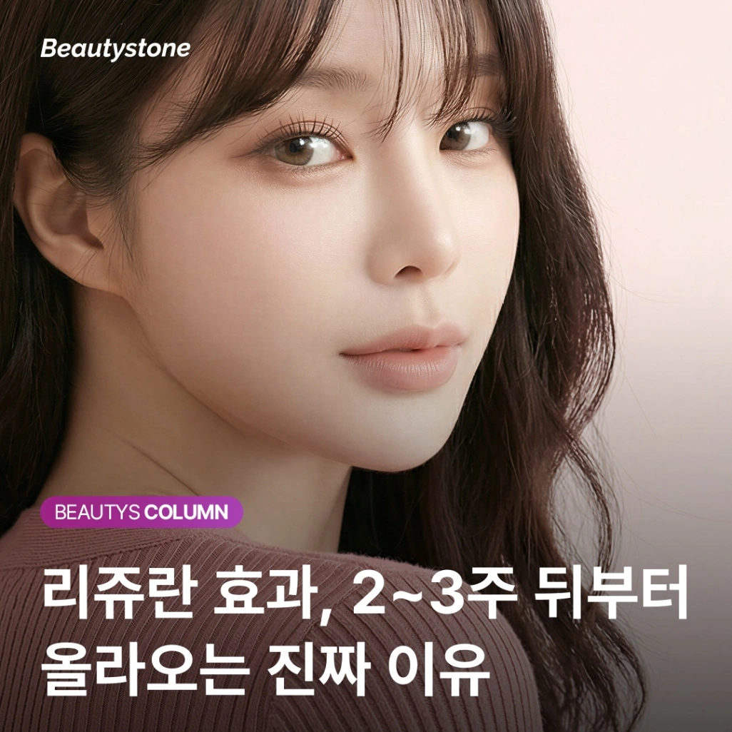 กลไกผลลัพธ์ของรีจูแรน 1