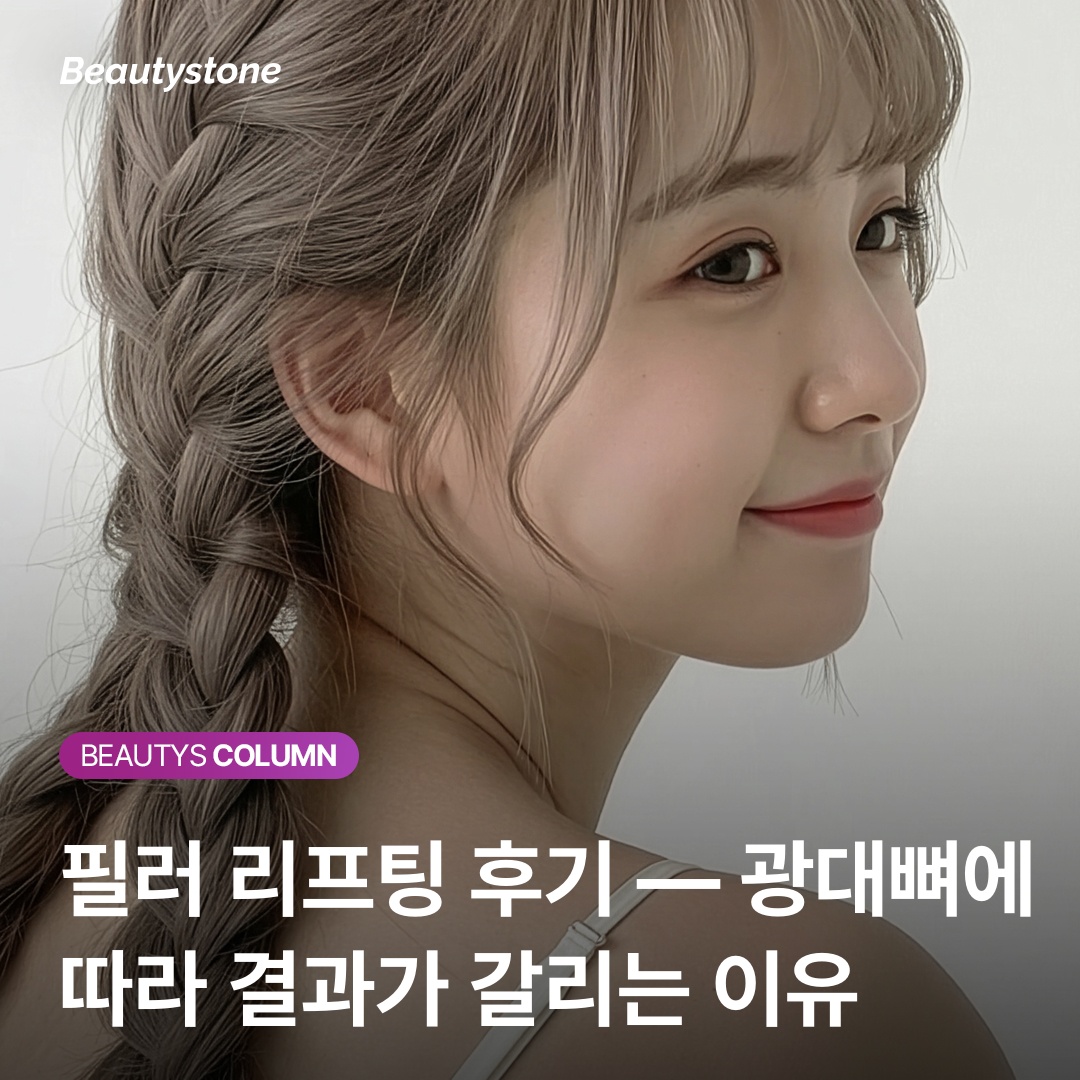 필러 리프팅 광대뼈 형태별 효과 차이