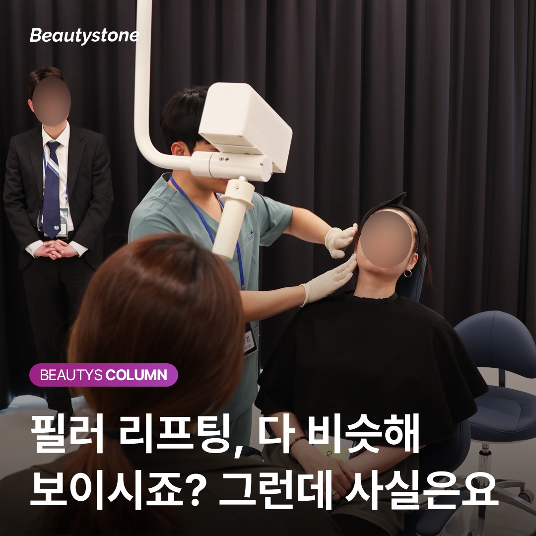 필러 리프팅 한쪽 먼저 시술 후 비교