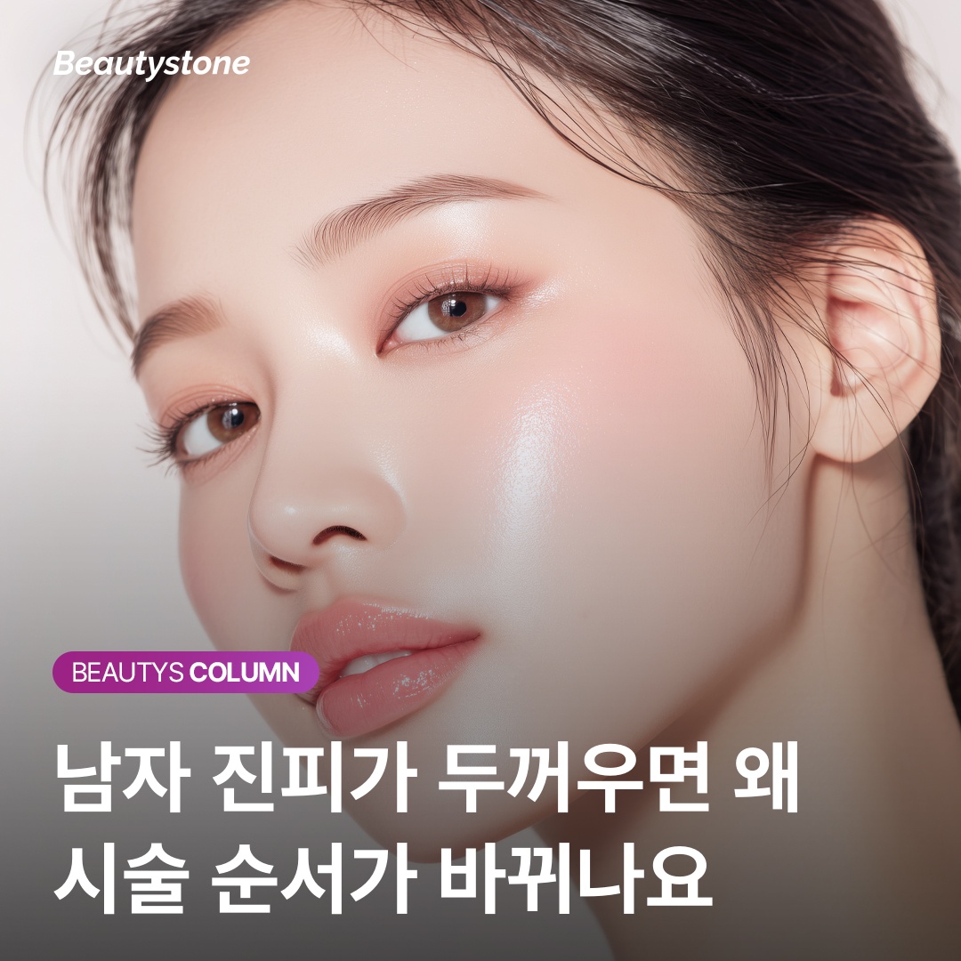 남자 부위별 필러 관자 턱선 이마