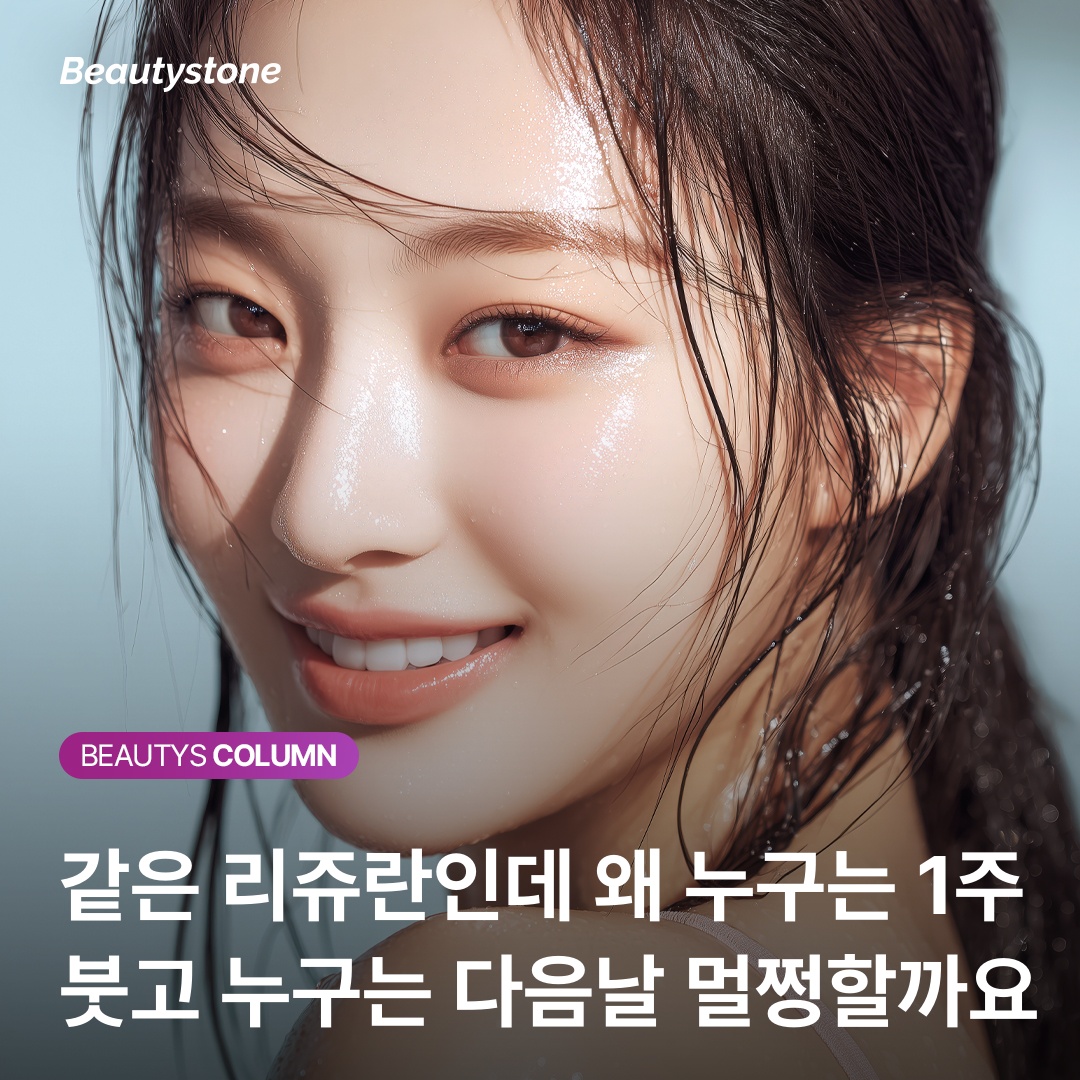 Skin booster approach by under-eye type