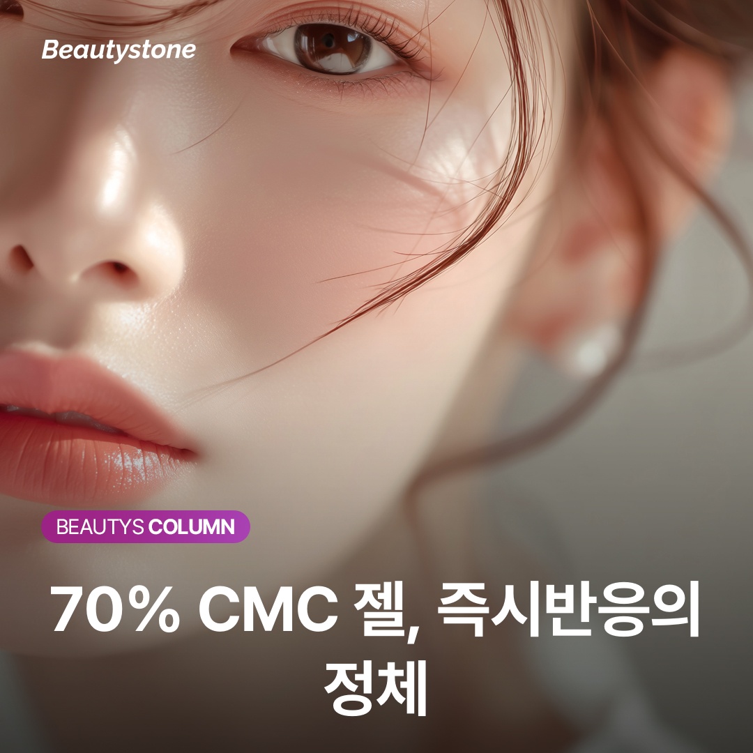 레디어스 시술 후기에서 CMC 젤로 인한 즉시 볼륨 체감과 이후 변화를 설명하는 개념도
