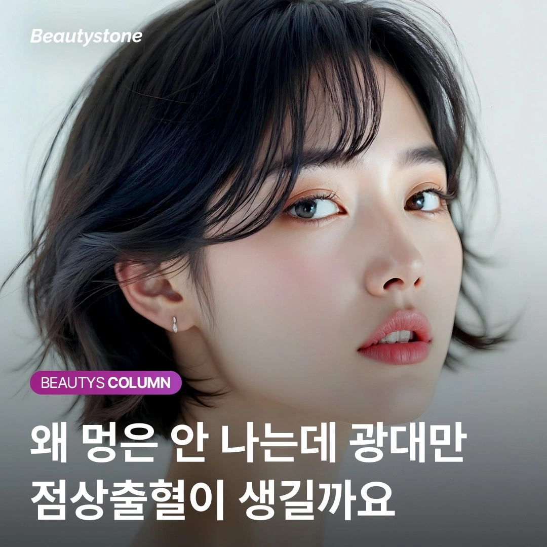 써마지 효과 시기와 부작용 방지법, 팁 압력 조절이 결과를 가릅니다