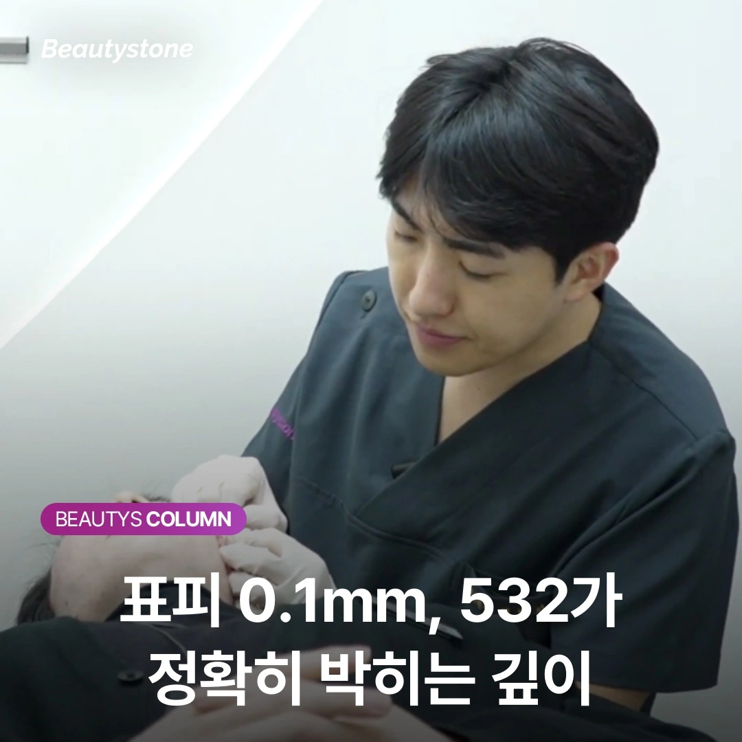 주근깨 레이저, 1064 토닝으로 효과 없다면 '532nm'이 정답인 이유