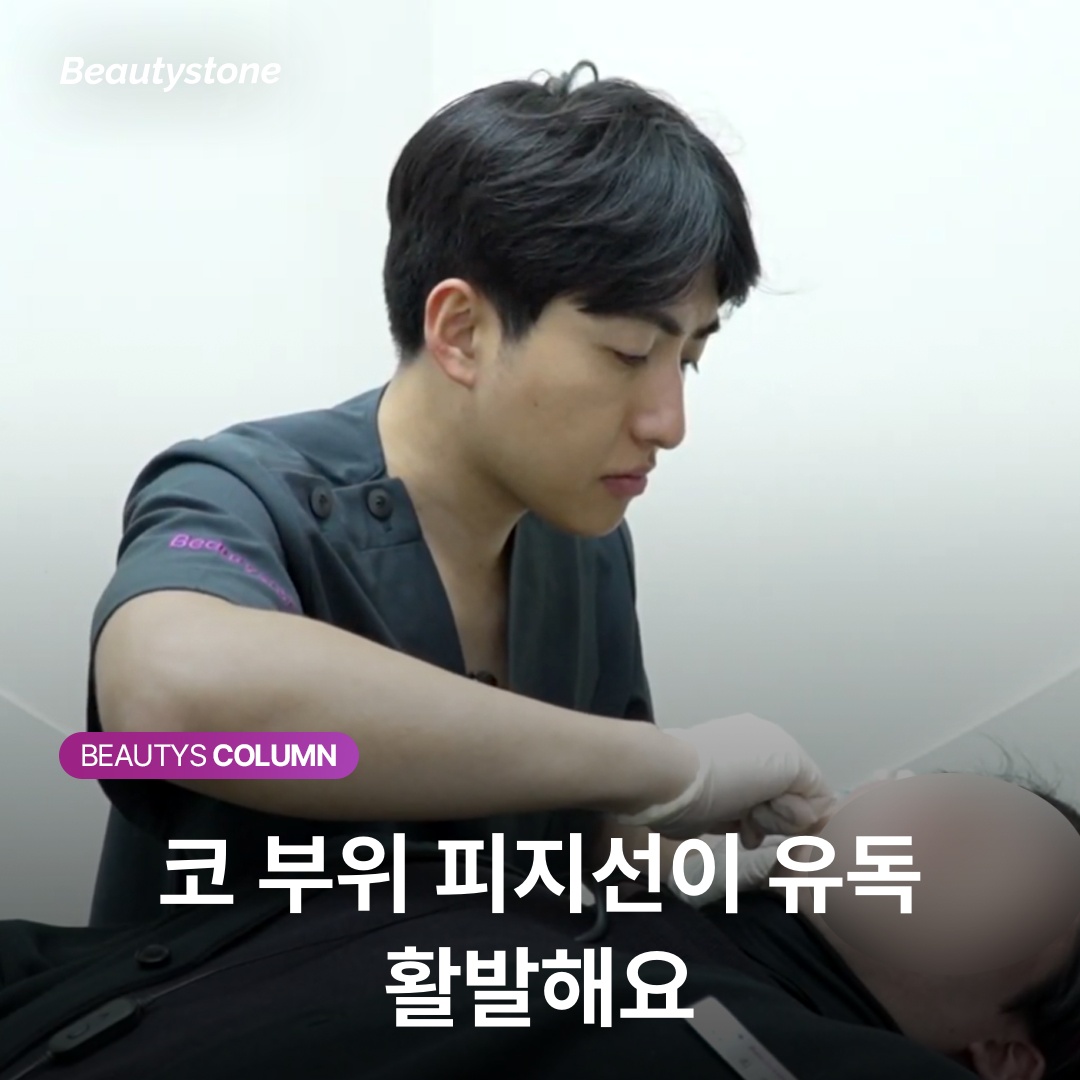 코 부위 피지선이 유독 활발해요