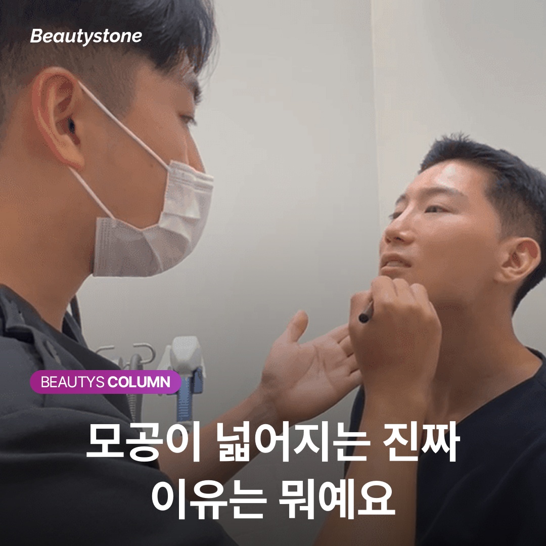 모공이 넓어지는 진짜 이유는 뭐예요