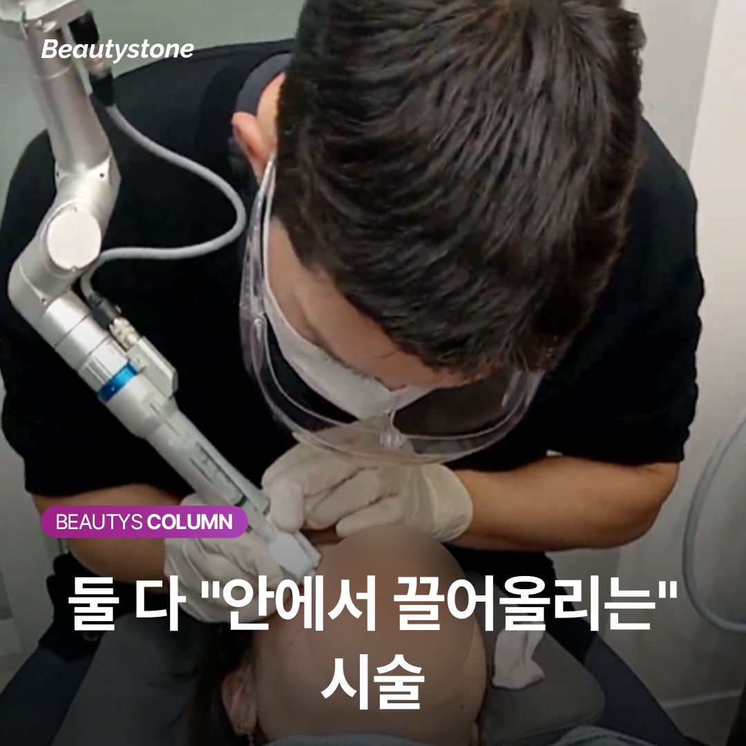 Both procedures lift from within