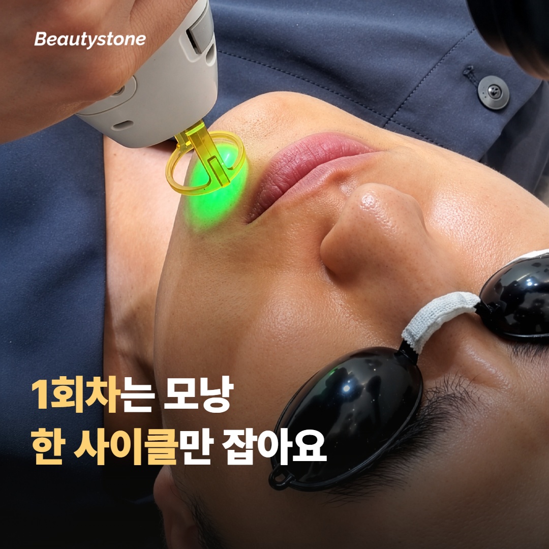 Session 1 only targets one hair follicle cycle