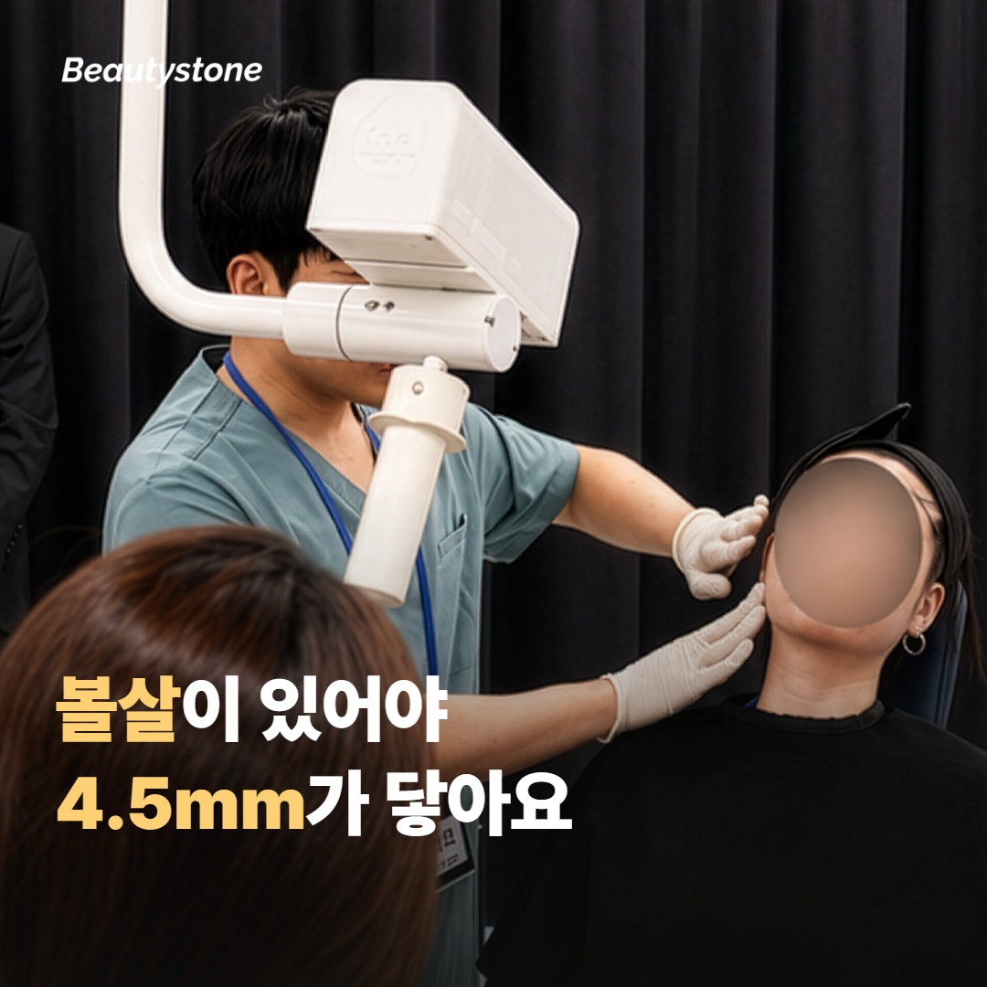 4.5mm 카트리지가 효과 있는 분과 덜한 분