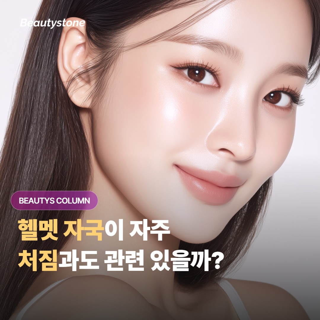 자전거 헬멧이나 안전모 자국이 자주 남는 분, 처짐과도 관련이 있을까?