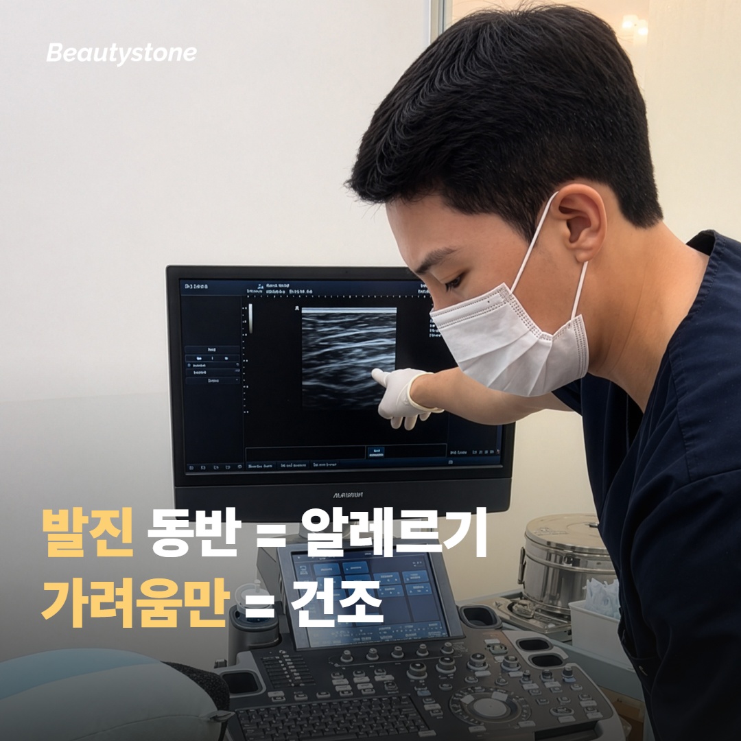 환절기 건조성 가려움의 패턴