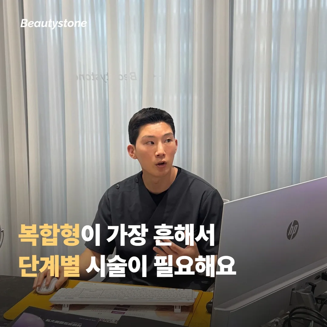 結構型 — 凹陷製造的陰影